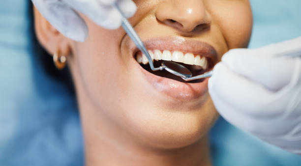 Best Emergency Treatment for Toothache in Hampton, MD