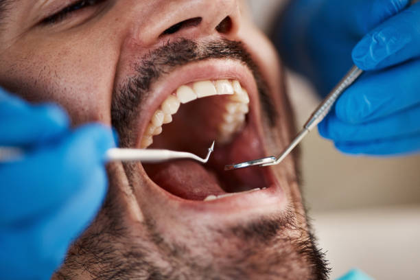 Best Emergency Treatment for Toothache in Hampton, MD